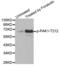 P21 (RAC1) Activated Kinase 1 antibody, abx000238, Abbexa, Western Blot image 