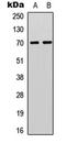 Ribosomal Protein S6 Kinase B1 antibody, LS-C368518, Lifespan Biosciences, Western Blot image 