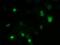 Zinc Finger Imprinted 2 antibody, NBP2-03325, Novus Biologicals, Immunocytochemistry image 