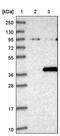 Zinc Finger Protein 177 antibody, PA5-51835, Invitrogen Antibodies, Western Blot image 
