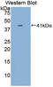 Interleukin 1 Receptor Type 1 antibody, LS-C294813, Lifespan Biosciences, Western Blot image 