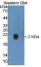 Gremlin 2, DAN Family BMP Antagonist antibody, LS-C375012, Lifespan Biosciences, Western Blot image 