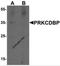 Caveolae Associated Protein 3 antibody, 7269, ProSci, Western Blot image 