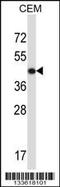 Actin Gamma 2, Smooth Muscle antibody, 57-103, ProSci, Western Blot image 