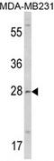 Collectin Subfamily Member 11 antibody, AP17227PU-N, Origene, Western Blot image 