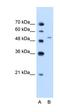 Nicotinamide Phosphoribosyltransferase antibody, orb324989, Biorbyt, Western Blot image 