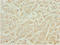 Leucine Zipper Like Transcription Regulator 1 antibody, LS-C682127, Lifespan Biosciences, Immunohistochemistry paraffin image 