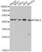 Proteasome 26S Subunit, ATPase 5 antibody, A13537, ABclonal Technology, Western Blot image 