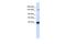 Protein turtle homolog A antibody, A12633, Boster Biological Technology, Western Blot image 