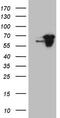 CWC27 Spliceosome Associated Cyclophilin antibody, M13346, Boster Biological Technology, Western Blot image 