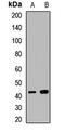Adhesion Regulating Molecule 1 antibody, LS-C667655, Lifespan Biosciences, Western Blot image 