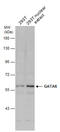 GATA Binding Protein 6 antibody, GTX129832, GeneTex, Western Blot image 