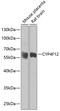 Cytochrome P450 Family 4 Subfamily F Member 12 antibody, GTX33137, GeneTex, Western Blot image 