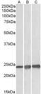 Peroxiredoxin 1 antibody, NBP1-06064, Novus Biologicals, Western Blot image 