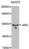 Janus Kinase 2 antibody, A11497, ABclonal Technology, Western Blot image 