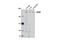 Leucine Rich Repeat Kinase 2 antibody, 13046S, Cell Signaling Technology, Western Blot image 