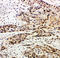 Caspase 14 antibody, LS-C313222, Lifespan Biosciences, Immunohistochemistry paraffin image 