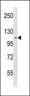 Serine Peptidase Inhibitor, Kazal Type 5 antibody, PA5-72481, Invitrogen Antibodies, Western Blot image 