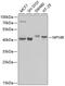 Neuropeptide Y Receptor Y4 antibody, GTX55725, GeneTex, Western Blot image 