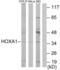 Homeobox A1 antibody, abx013501, Abbexa, Western Blot image 