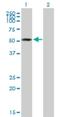Zinc Finger CCCH-Type Containing 10 antibody, H00084872-B01P, Novus Biologicals, Western Blot image 