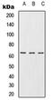 URI1 Prefoldin Like Chaperone antibody, LS-C353085, Lifespan Biosciences, Western Blot image 