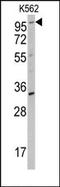 Receptor Tyrosine Kinase Like Orphan Receptor 2 antibody, AP14416PU-N, Origene, Western Blot image 