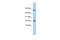 DnaJ Heat Shock Protein Family (Hsp40) Member C24 antibody, A12354, Boster Biological Technology, Western Blot image 