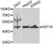 Keratin 16 antibody, LS-C349313, Lifespan Biosciences, Western Blot image 