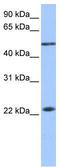 E3 SUMO-protein ligase PIAS2 antibody, TA335365, Origene, Western Blot image 