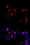 MYC Associated Factor X antibody, MBS125025, MyBioSource, Immunofluorescence image 