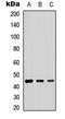 Beta-1,4-Galactosyltransferase 2 antibody, LS-C354555, Lifespan Biosciences, Western Blot image 
