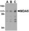 Interferon Induced With Helicase C Domain 1 antibody, TA306393, Origene, Western Blot image 