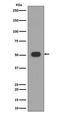 Mixed Lineage Kinase Domain Like Pseudokinase antibody, M00535, Boster Biological Technology, Western Blot image 