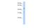 Short Chain Dehydrogenase/Reductase Family 16C Member 5 antibody, A10605, Boster Biological Technology, Western Blot image 