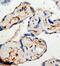 Endothelin Receptor Type B antibody, PA1031, Boster Biological Technology, Immunohistochemistry paraffin image 