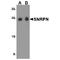 Small Nuclear Ribonucleoprotein Polypeptide N antibody, TA349164, Origene, Western Blot image 