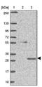 General Transcription Factor IIH Subunit 3 antibody, PA5-62808, Invitrogen Antibodies, Western Blot image 