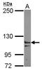 Exportin 6 antibody, LS-C155642, Lifespan Biosciences, Western Blot image 