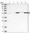 Transcriptional adapter 2-beta antibody, NBP1-91649, Novus Biologicals, Western Blot image 