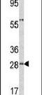 Orosomucoid 1 antibody, PA5-13472, Invitrogen Antibodies, Western Blot image 