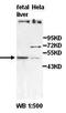 Zinc Finger And BTB Domain Containing 14 antibody, orb77791, Biorbyt, Western Blot image 
