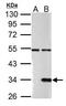 Galectin 9 antibody, PA5-32252, Invitrogen Antibodies, Western Blot image 