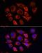 High Mobility Group AT-Hook 1 antibody, LS-C746786, Lifespan Biosciences, Immunofluorescence image 