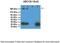 ATP Binding Cassette Subfamily C Member 9 antibody, PA5-42398, Invitrogen Antibodies, Western Blot image 