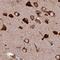 Lysyl-TRNA Synthetase antibody, PA5-59524, Invitrogen Antibodies, Immunohistochemistry frozen image 