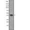 Calcium/Calmodulin Dependent Protein Kinase I antibody, abx148845, Abbexa, Western Blot image 