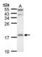 Ubiquitin-conjugating enzyme E2 D1 antibody, PA5-28959, Invitrogen Antibodies, Western Blot image 