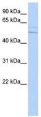 Potassium Voltage-Gated Channel Subfamily C Member 4 antibody, TA338546, Origene, Western Blot image 