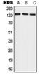 RecQ Like Helicase 4 antibody, orb214895, Biorbyt, Western Blot image 